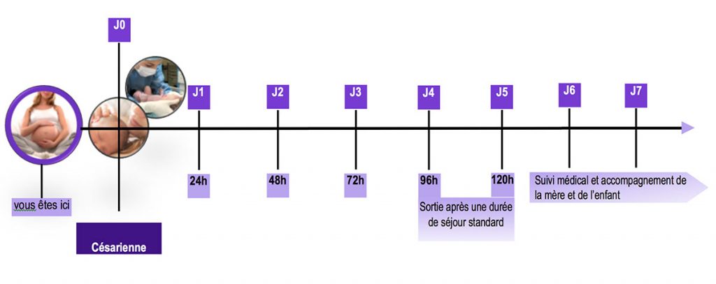 Protocole et suivi accouchement par césarienne